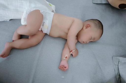 梧州宝宝脸上有白色斑块